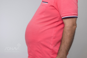gordura abdominal nos homens